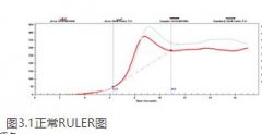 潤(rùn)滑油檢測(cè)中抗氧化劑含量(RULER)是什么？
